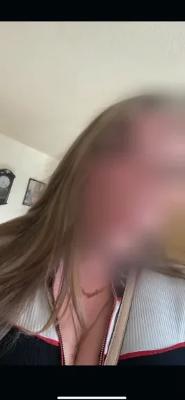 Molly, 25